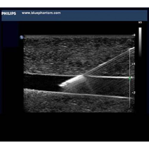 Advanced Emergency Medicine Point Of Care Ultrasound